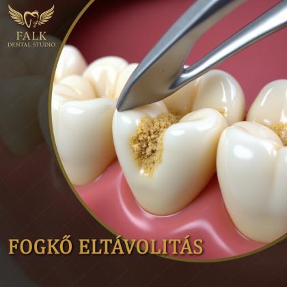 Oral hygiene treatments