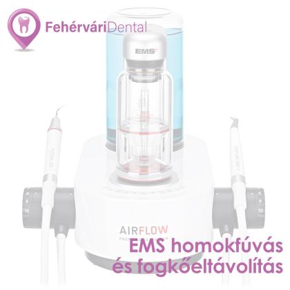 EMS homokfúvás és fogkőeltávolítás
