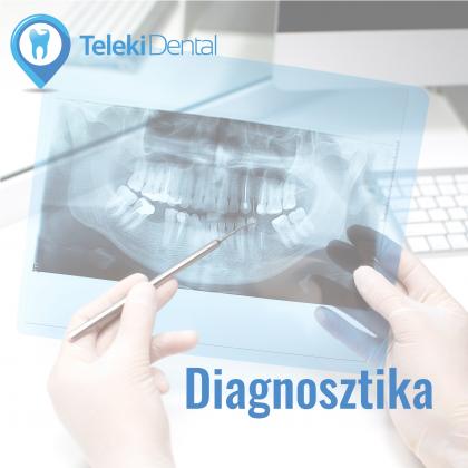 Dental diagnostics - dental screening