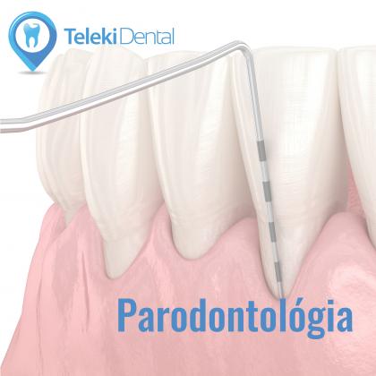 Parodontológia Parodontológia